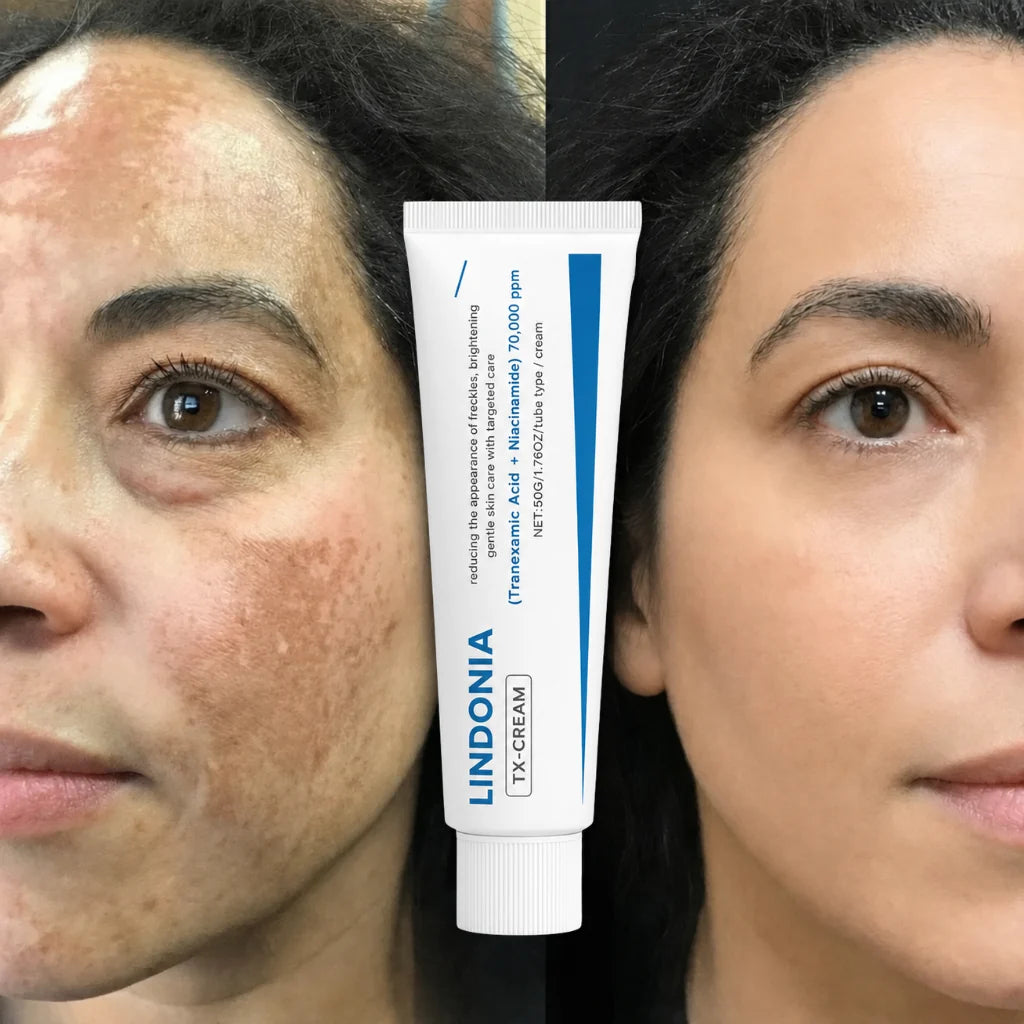 (2x1) Lindonia® Corrector de Manchas